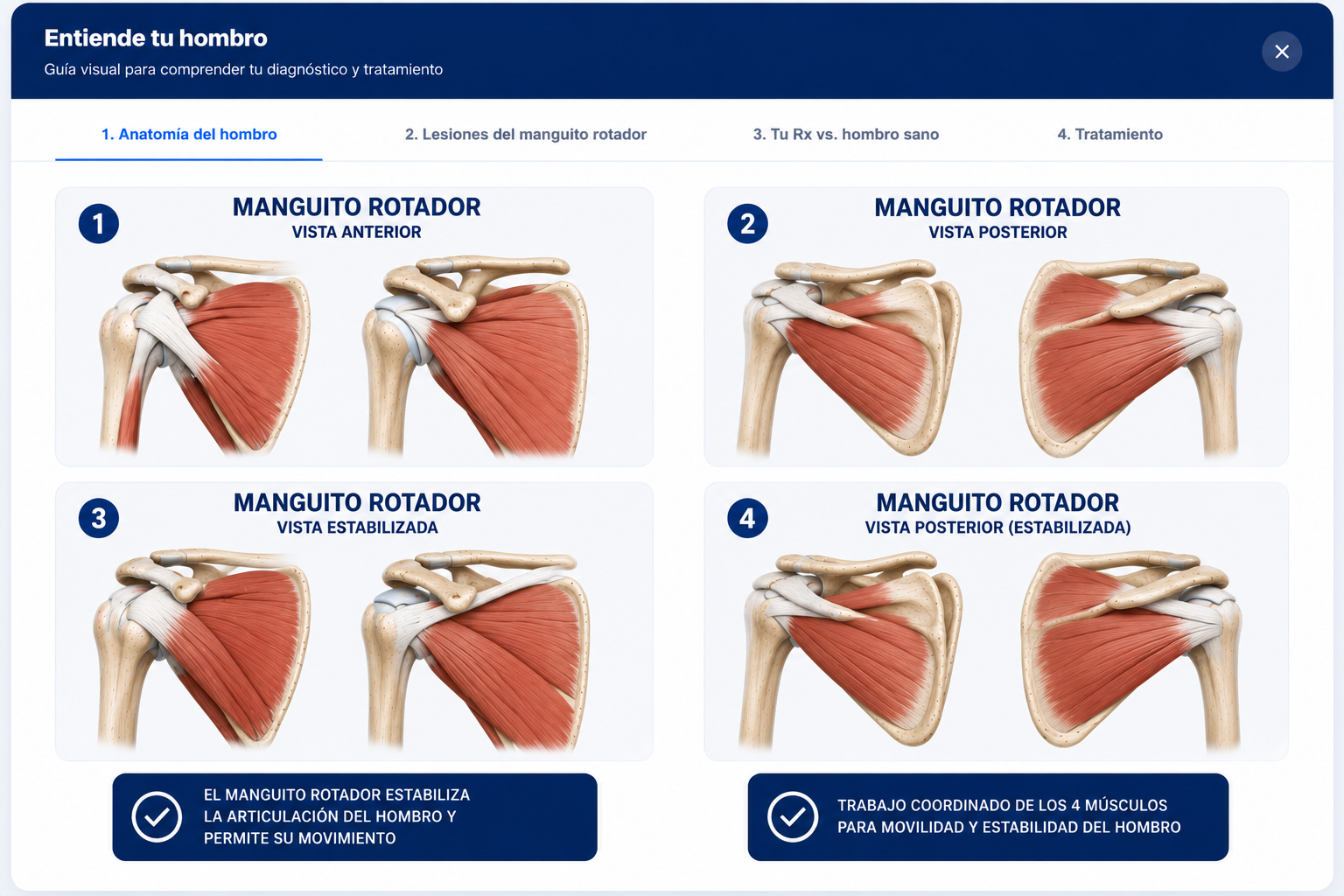 Anatomía del hombro — manguito rotador, bursa, acromion
